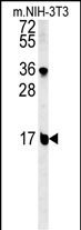 1 - BLOC1S2 Antibody (Center) AP5538c