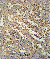 14 - C19orf39 Antibody (Center) AP5547c