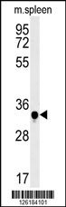 1 - C19orf39 Antibody (Center) AP5547c