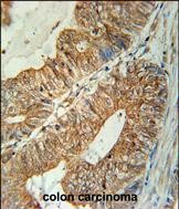14 - TSPAN3 Antibody (Center) AP5559c