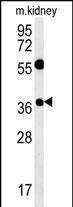 1 - TSPAN3 Antibody (Center) AP5559c