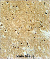 14 - IPO9 Antibody (N-term) AP5564a