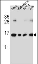 1 - H2AFJ Antibody (N-term) AP5572a