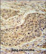 14 - TAF1D Antibody  (N-term) AP5597a