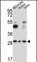 1 - TAF1D Antibody  (N-term) AP5597a