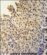 14 - DI3L1 Antibody  (N-term) AP5614a