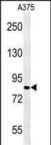 1 - CPEB4 Antibody (N-term) AP5628a