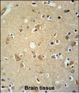 14 - P2RX7 Antibody (C-term) AP5674b