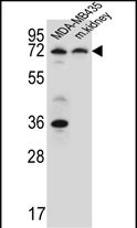 1 - P2RX7 Antibody (C-term) AP5674b