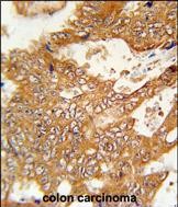 14 - FBXO34 Antibody (C-term) AP5692b