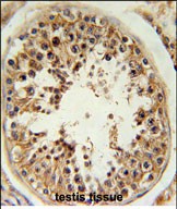 14 - RSPO4 Antibody (C-term) AP5711b