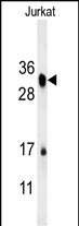 1 - RSPO4 Antibody (C-term) AP5711b