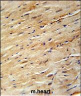 14 - KIF24 Antibody (N-term) AP5720A