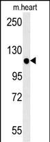 1 - KIF24 Antibody (N-term) AP5720A