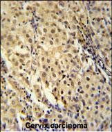 14 - FOXC2 Antibody (Center S174) AP5750c