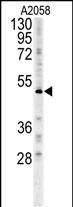 1 - FOXC2 Antibody (Center S174) AP5750c