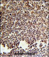 14 - KIR2DS3 Antibody (C-term) AP5763b