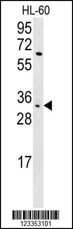 1 - KIR2DS3 Antibody (C-term) AP5763b