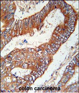 14 - KLHL6 Antibody  (C-term) AP5793b