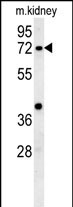 1 - KLHL6 Antibody  (C-term) AP5793b