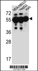 1 - ANKRD57 Antibody (C-term) AP5802b