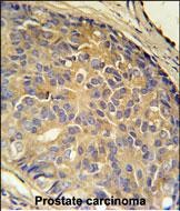 14 - LOH12CR1 Antibody (C-term) AP5806B