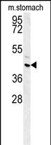 1 - FAM26E Antibody (C-term) AP5814B