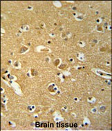 14 - HSPC142 Antibody (N-term) AP8573a