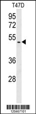 1 - HSPC142 Antibody (N-term) AP8573a