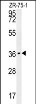 1 - CLEC12A Antibody (Center) AP10037c