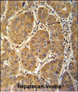 14 - MCEE Antibody  (C-term) AP10040B
