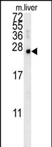 1 - MCEE Antibody  (C-term) AP10040B