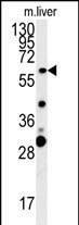 1 - ZCCHC5 Antibody (N-term) AP10044A