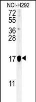 1 - C17orf91 Antibody (Center) AP10082c