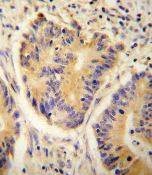 14 - ADH4 Antibody (C-term) AP10128b