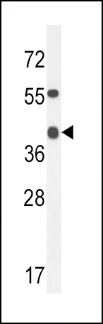 1 - ADH4 Antibody (C-term) AP10128b