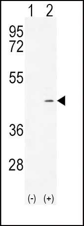 1 - ADH4 Antibody (C-term) AP10128b