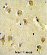 14 - PP1R14C Antibody (C-term) AP10151b