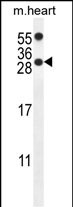 1 - PP1R14C Antibody (C-term) AP10151b