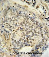 14 - FUS Antibody (C-term) AP10187b