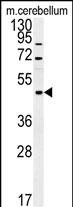 1 - FUS Antibody (C-term) AP10187b