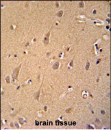 14 - GCC2 Antibody (C-term) AP10197b