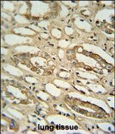 14 - GGTLC2 Antibody (Center) AP10216C