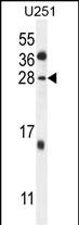 1 - GGTLC2 Antibody (Center) AP10216C