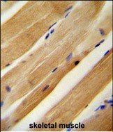 14 - MLXIP Antibody (N-term) AP10228a