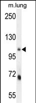 1 - MLXIP Antibody (N-term) AP10228a