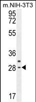 1 - CLDN22 Antibody (Center) AP10232c