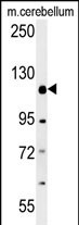 1 - RADIL Antibody (C-term) AP10237b