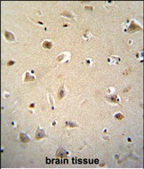 14 - RGAG4 Antibody (C-term) AP10249b