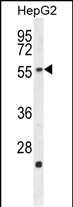 1 - RGAG4 Antibody (C-term) AP10249b